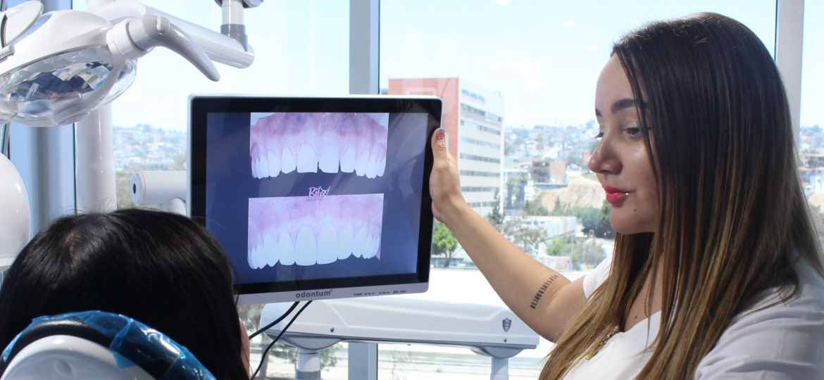 <strong>Bites Creadores de Sonrisas Is a Dental Clinic in Tijuana, Baja California, That Specializes in Veneers. Discover All Their Services Below!</strong>