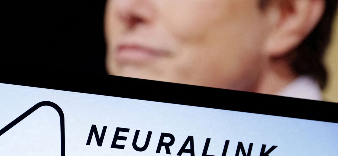 Elon Musk's brain chip company Neuralink says it has won FDA approval for human trials